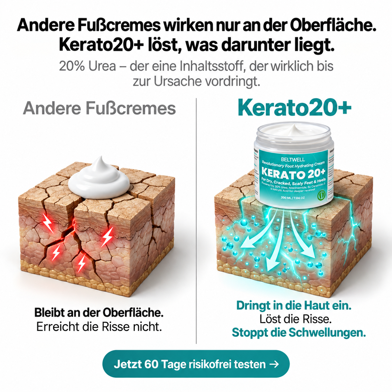 Urea 20% Intensiv-Fußcreme für trockene & rissige Füße, nicht fettend